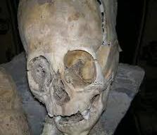 از کشف جمجمه تا امدادگرانِ گرفتار در شعله های آتش + فیلم از کشف جمجمه تا امدادگرانِ گرفتار در شعله های آتش + فیلم