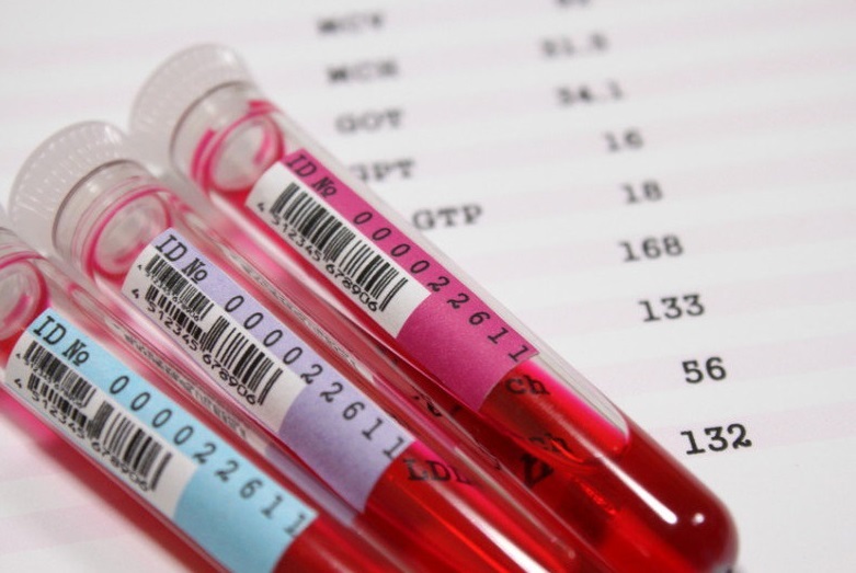 7 علامت شگفت انگیز افت ناگهانی قند خون