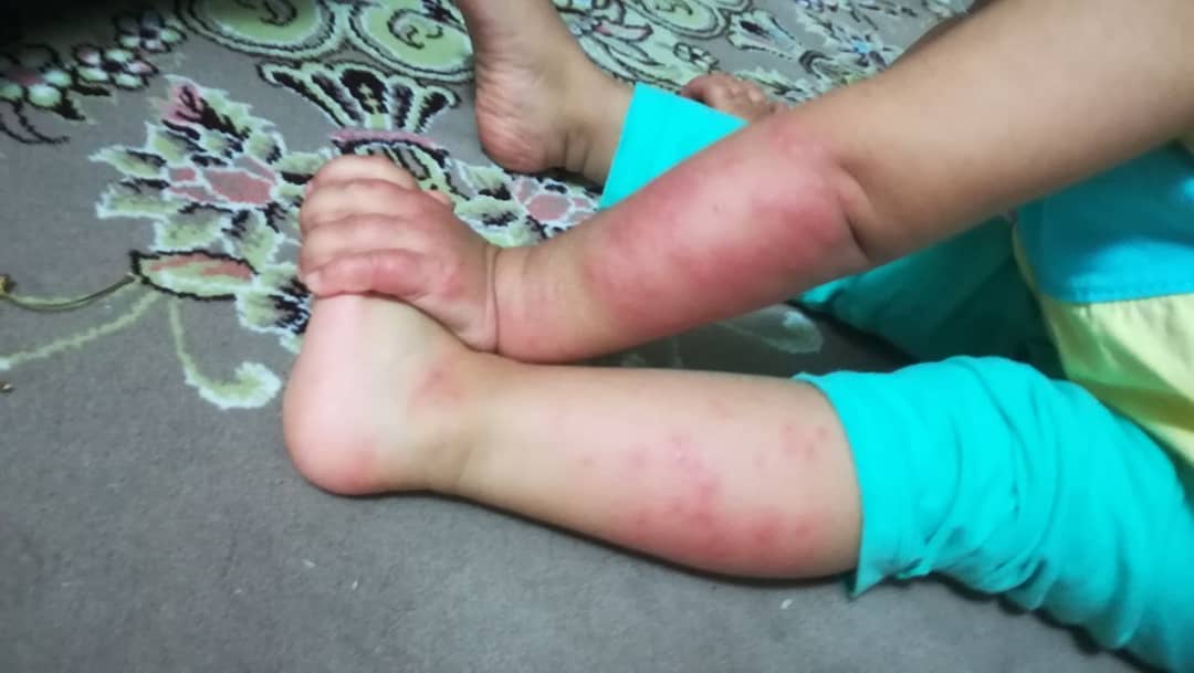 نیش و نوش‌های یک دریاچه فاضلابی