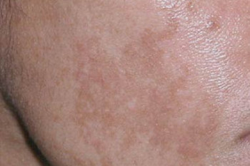 مردان لک بارداری می گیرند