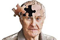 امکان تشخیص زودهنگام آلزایمر از طریق چشم‌ها