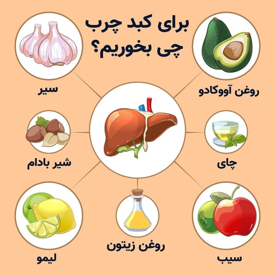راه پیشگیری و درمان کبد چرب در طب سنتی